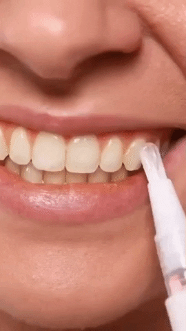 LAPIZ BLANQUEADOR DENTAL WHITE